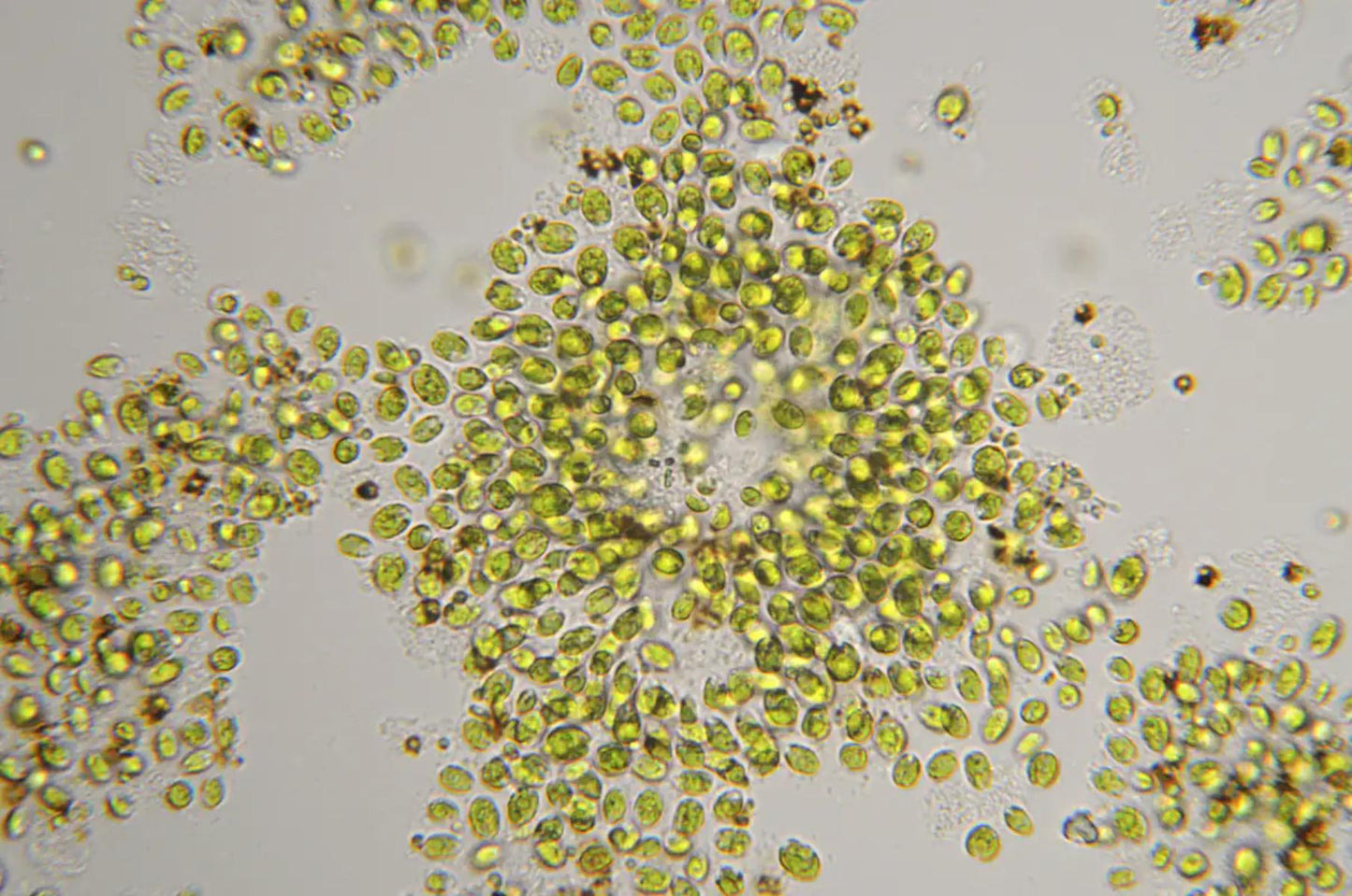 Chlorella vulgaris
