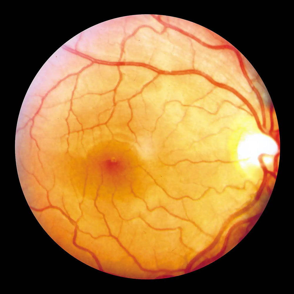 
                    
                      Fórmula para os olhos
                    
                  